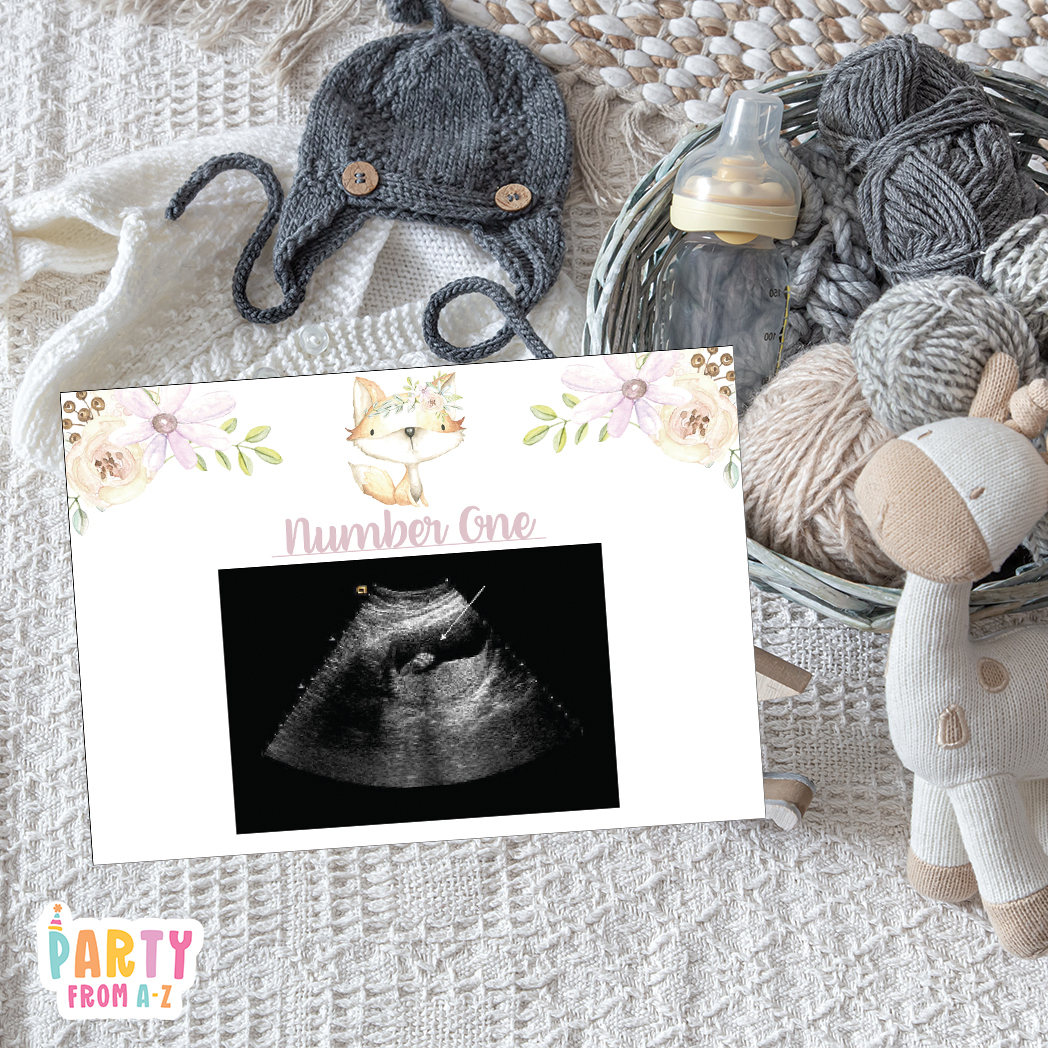 Baby Shower Ultrasound Game