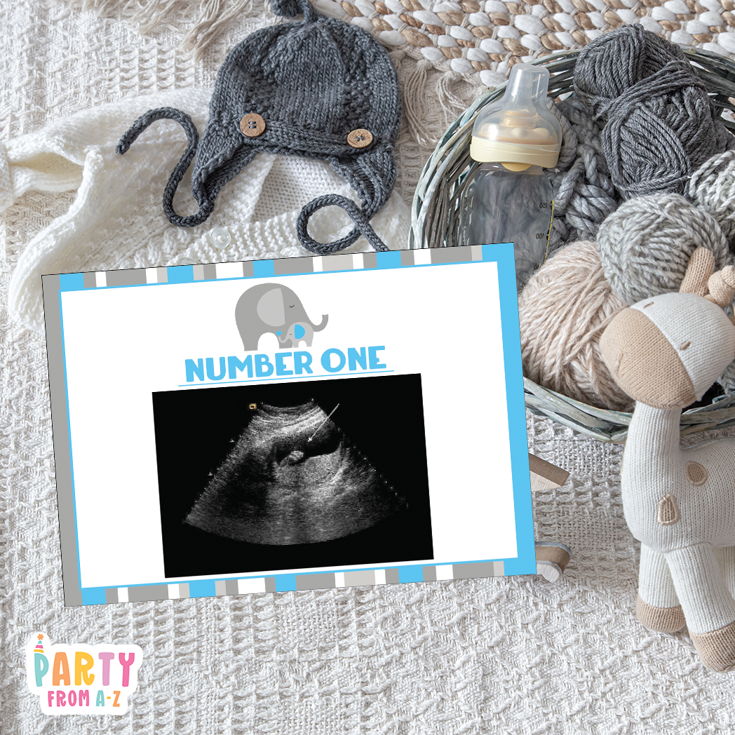 Baby Shower Ultrasound Game