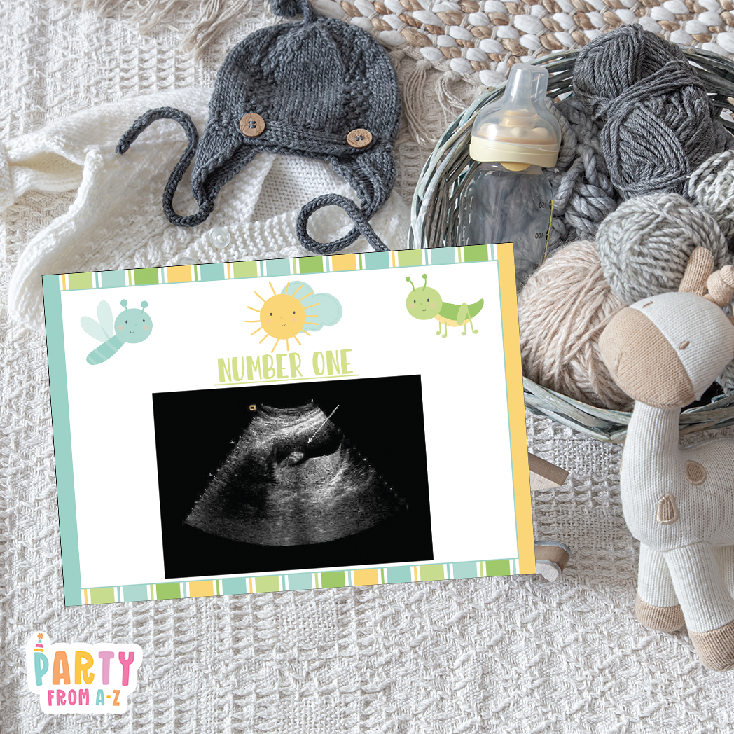 Baby Shower Ultrasound Game