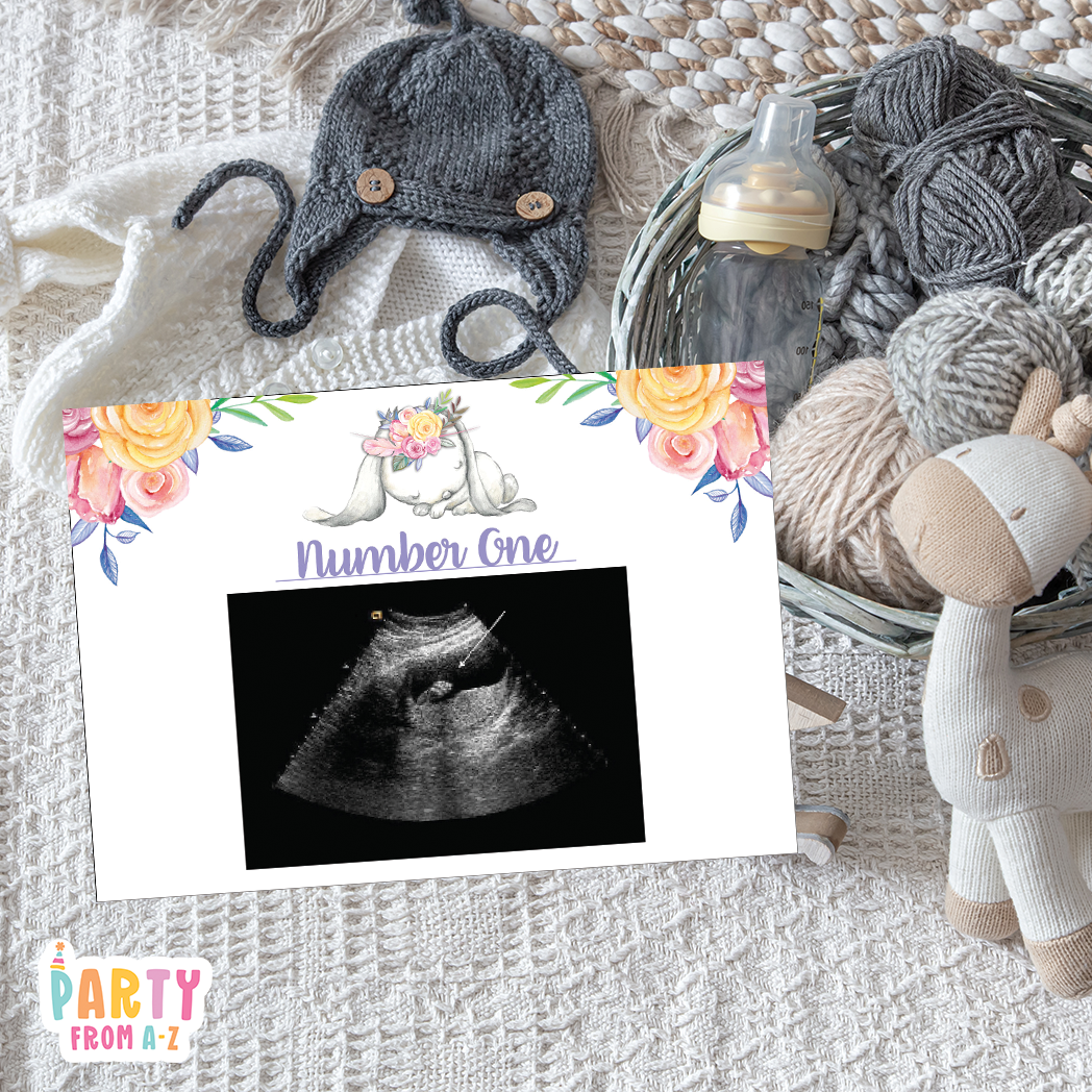 Baby Shower Ultrasound Game