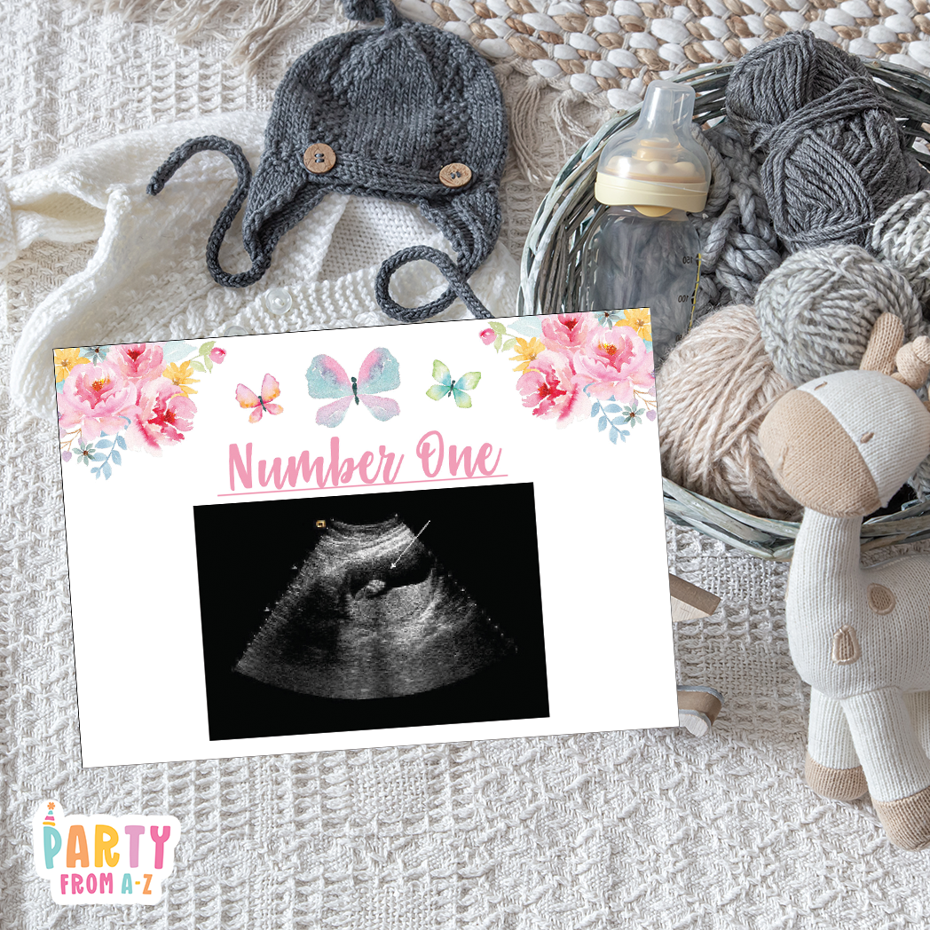 Baby Shower Ultrasound Game