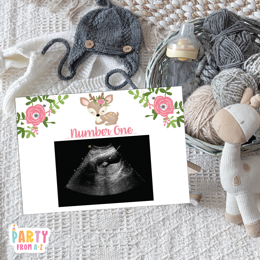 Baby Shower Ultrasound Game