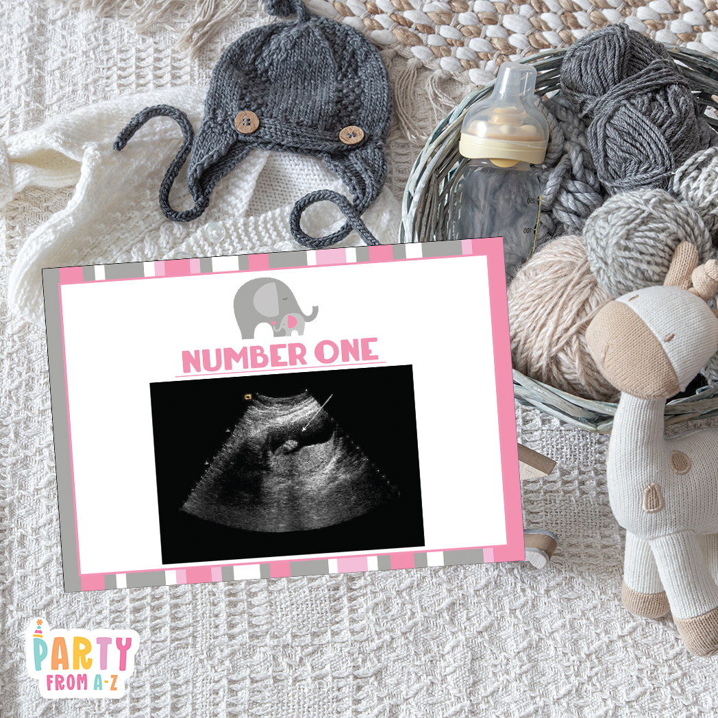 Baby Shower Ultrasound Game