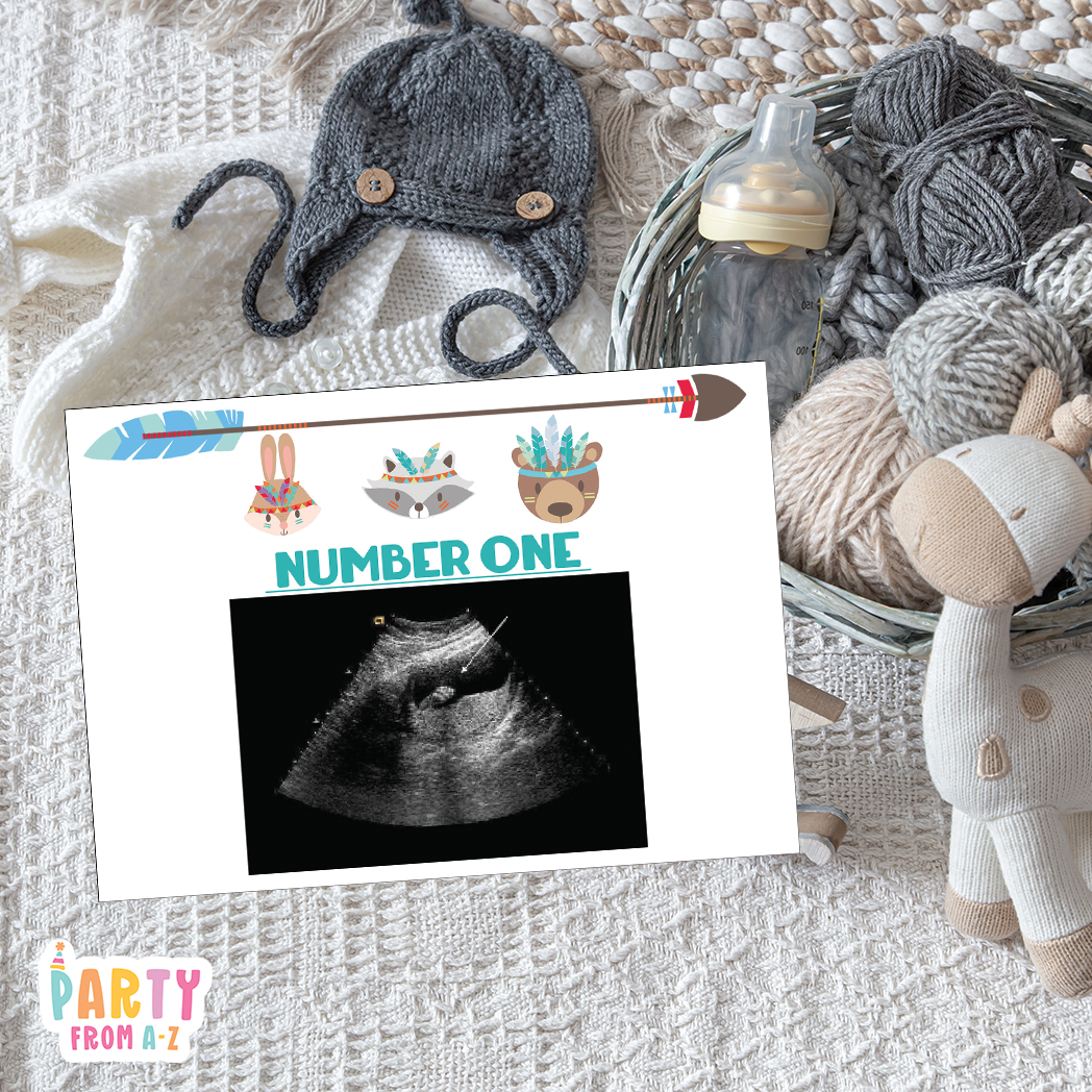 Baby Shower Ultrasound Game