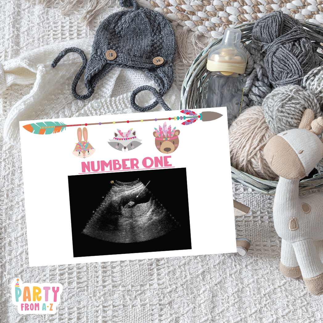 Baby Shower Ultrasound Game